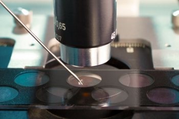 Фото:ЭМИС определение